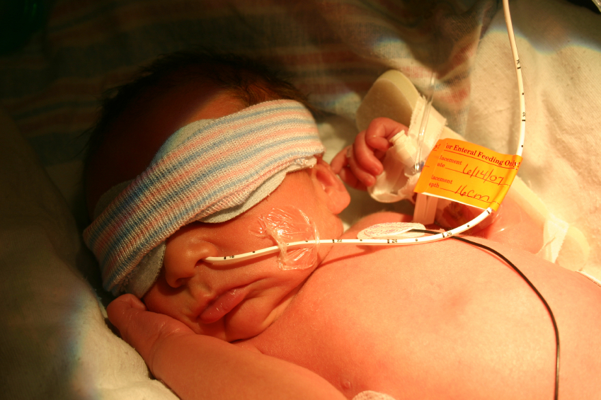 Weshalb Neugeborene gelb werden —